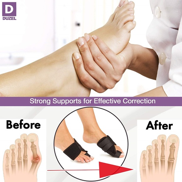 Bunion Splints Bunion Corrector - Picture 4 of 7